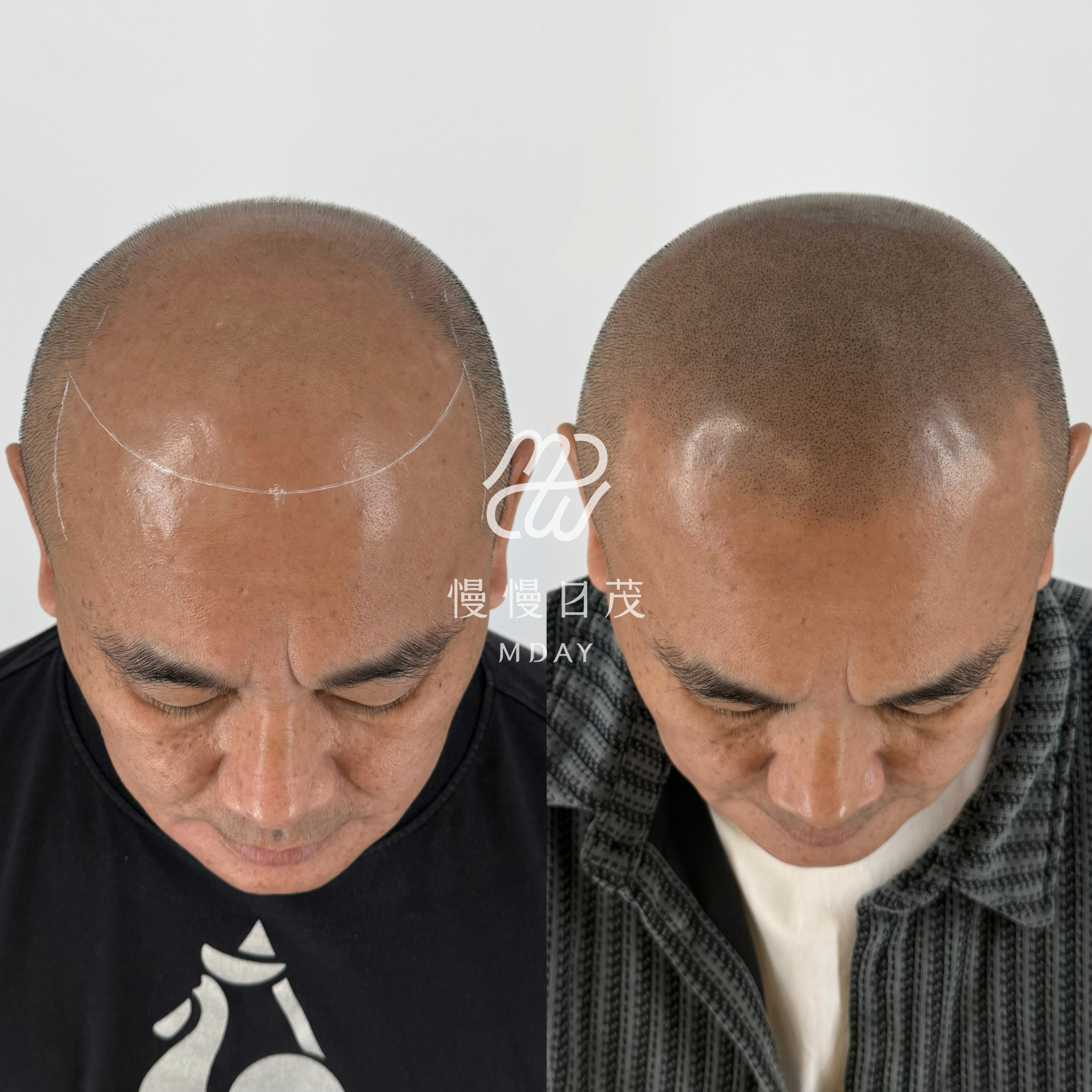 胖虎 Before After 對比