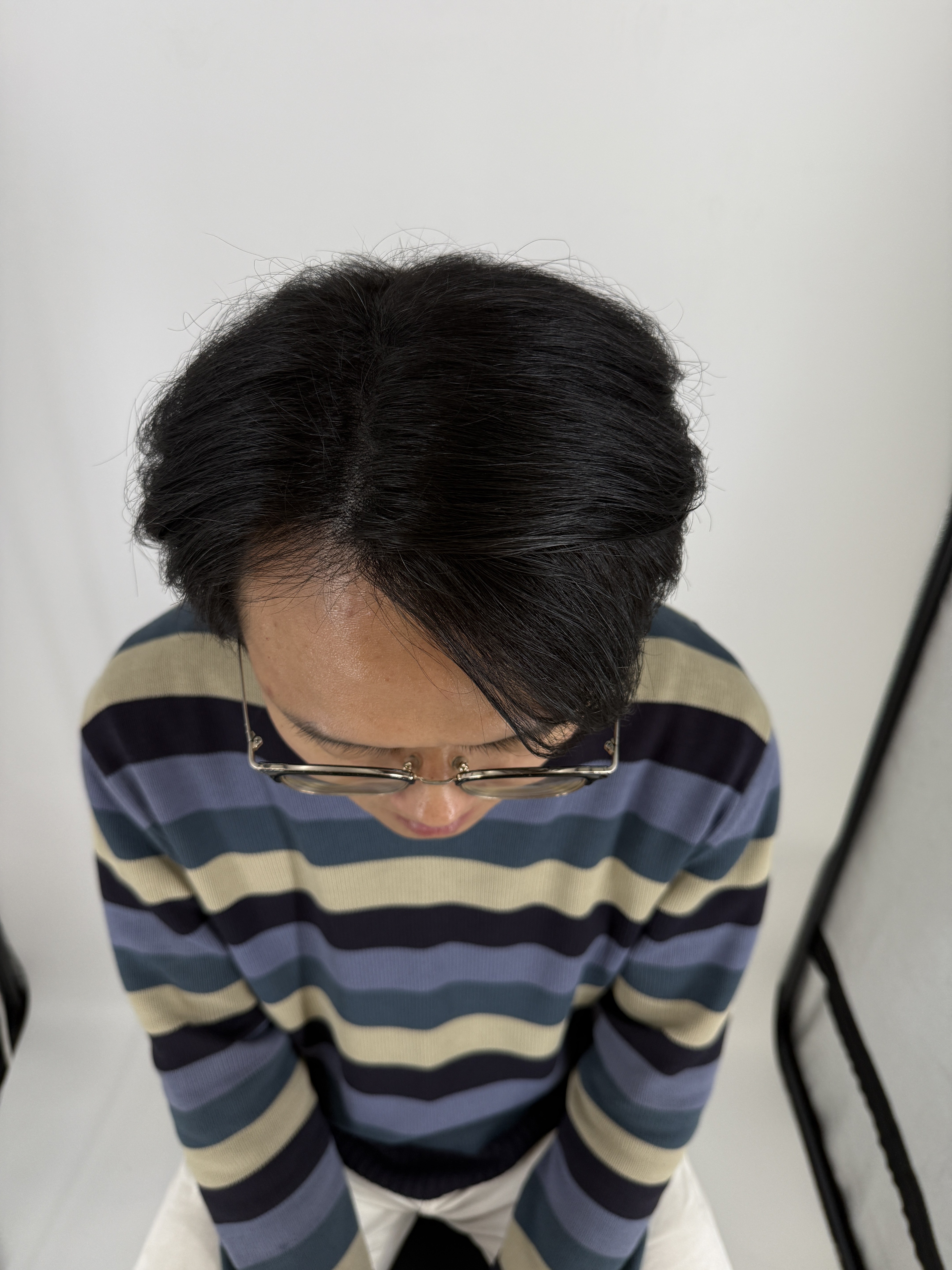 湯圓哥 After 照片