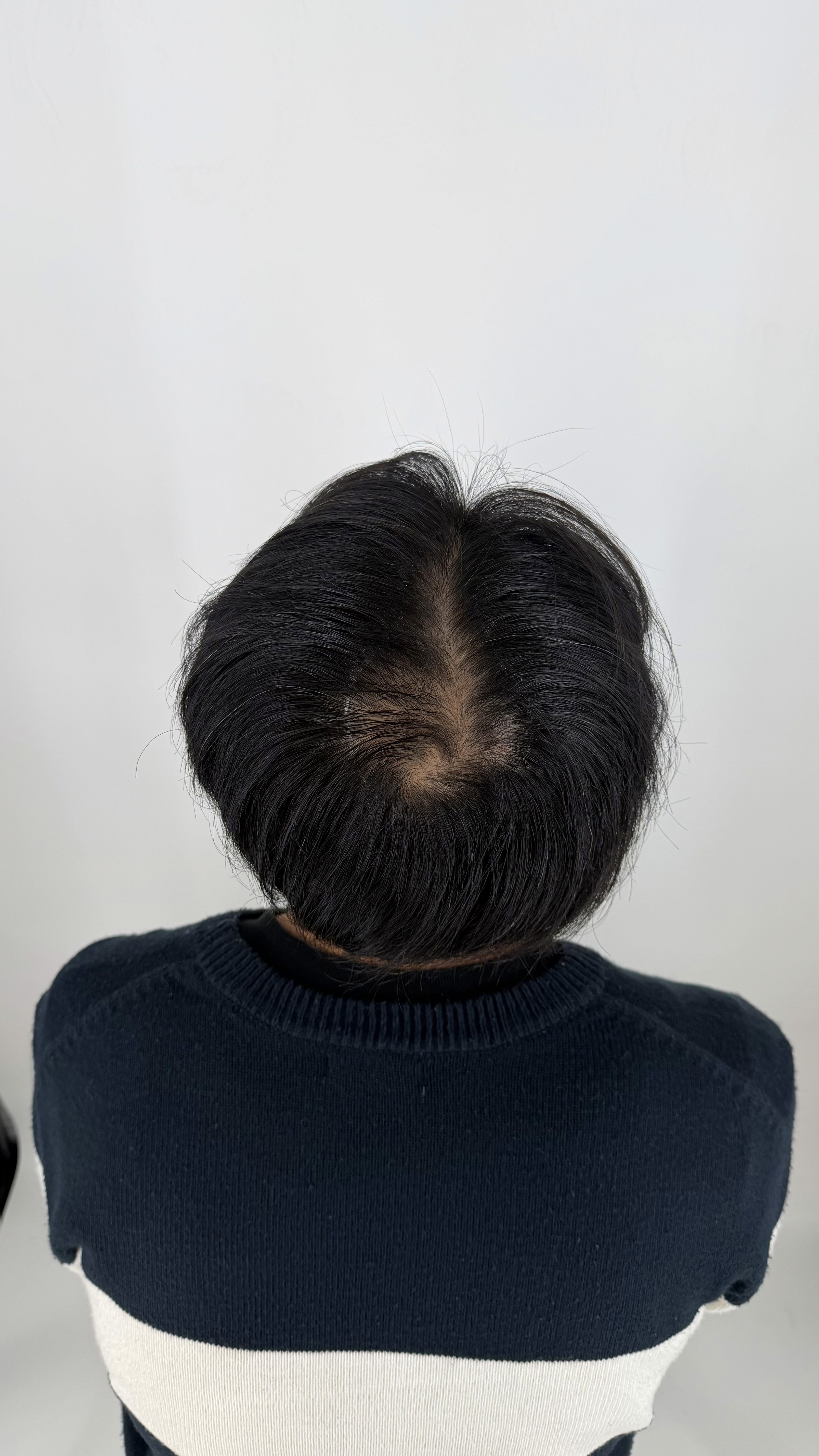 湯圓哥 Before 照片