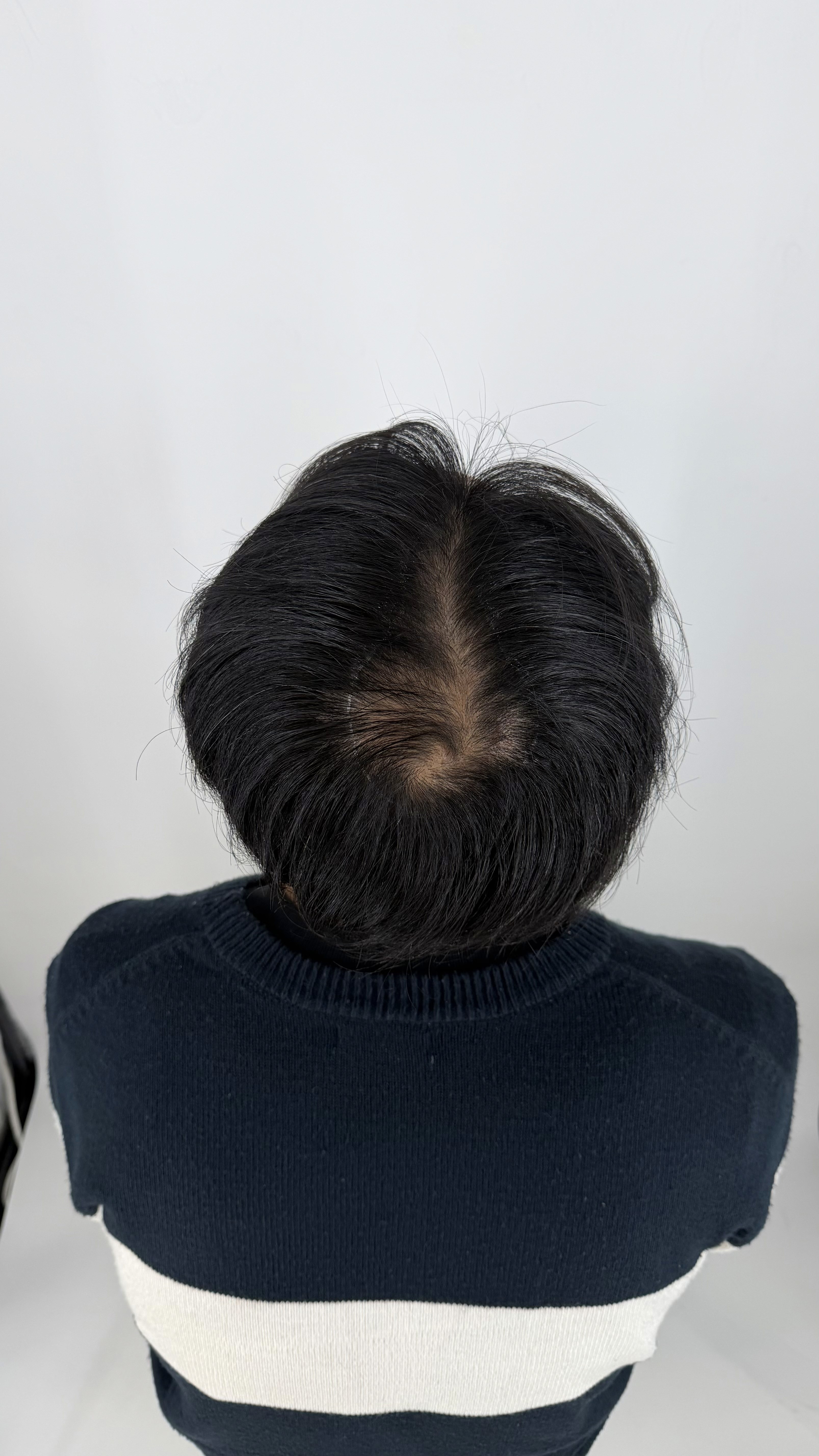 湯圓哥 Before 照片