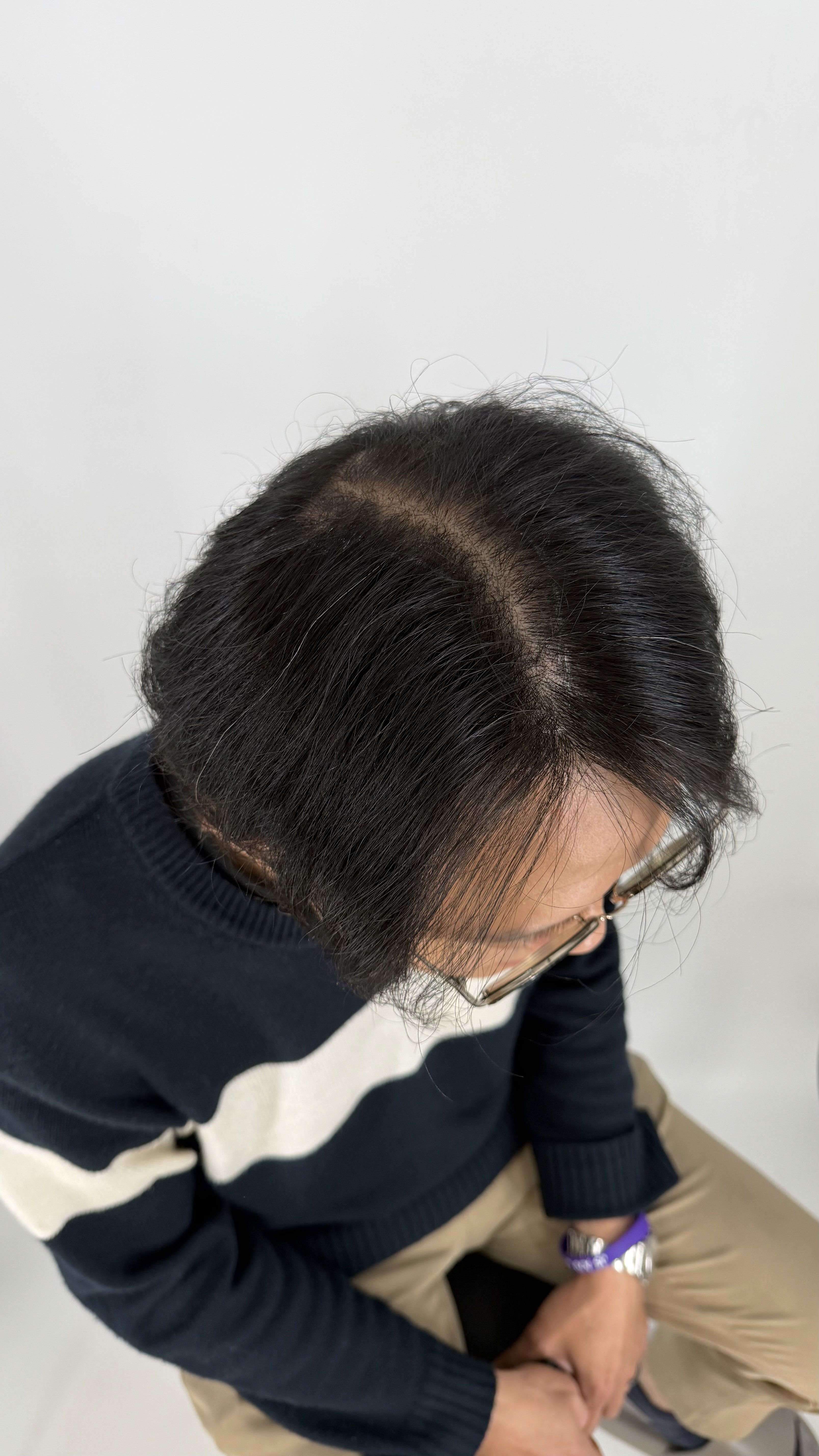湯圓哥 Before 照片