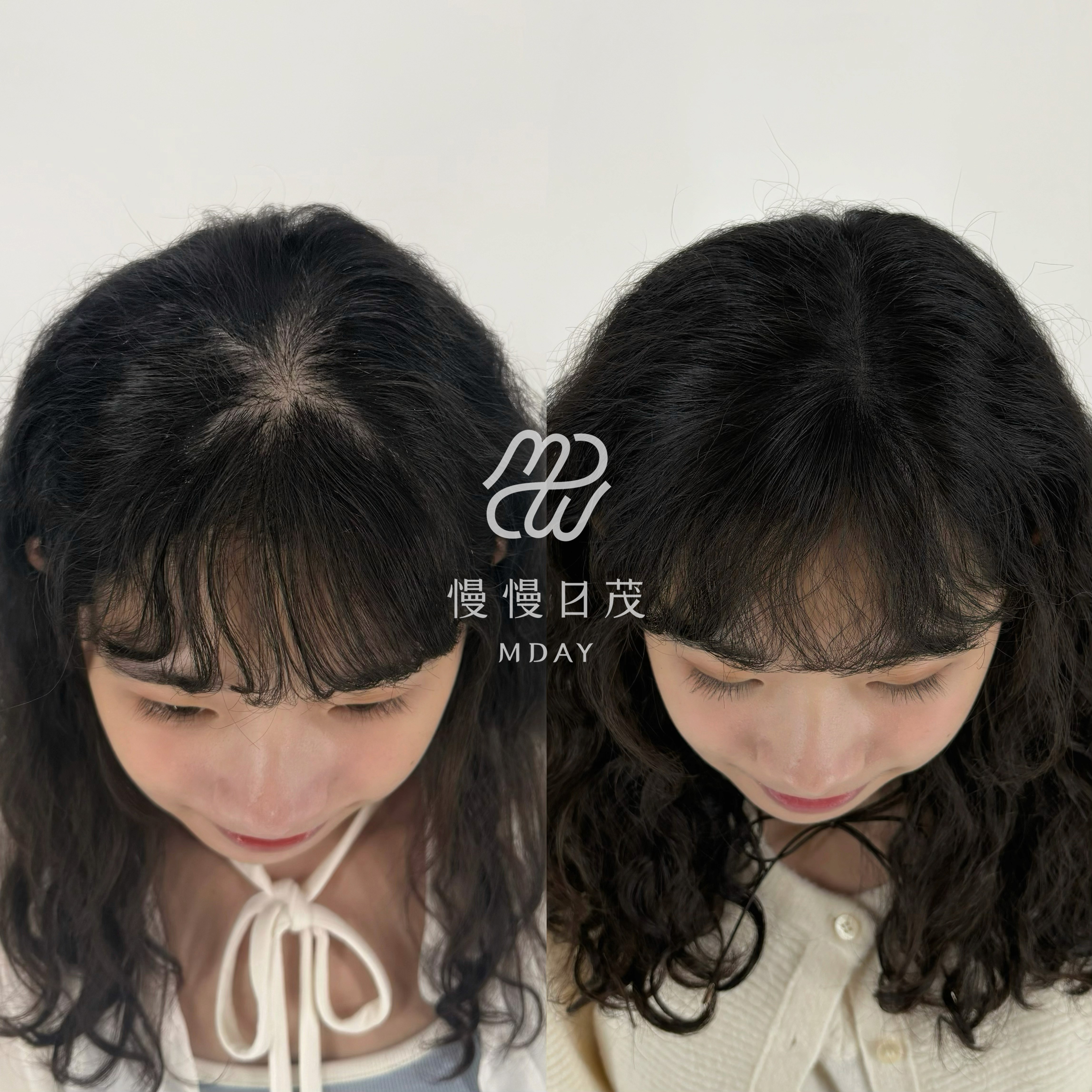 禹方 Before After 對比