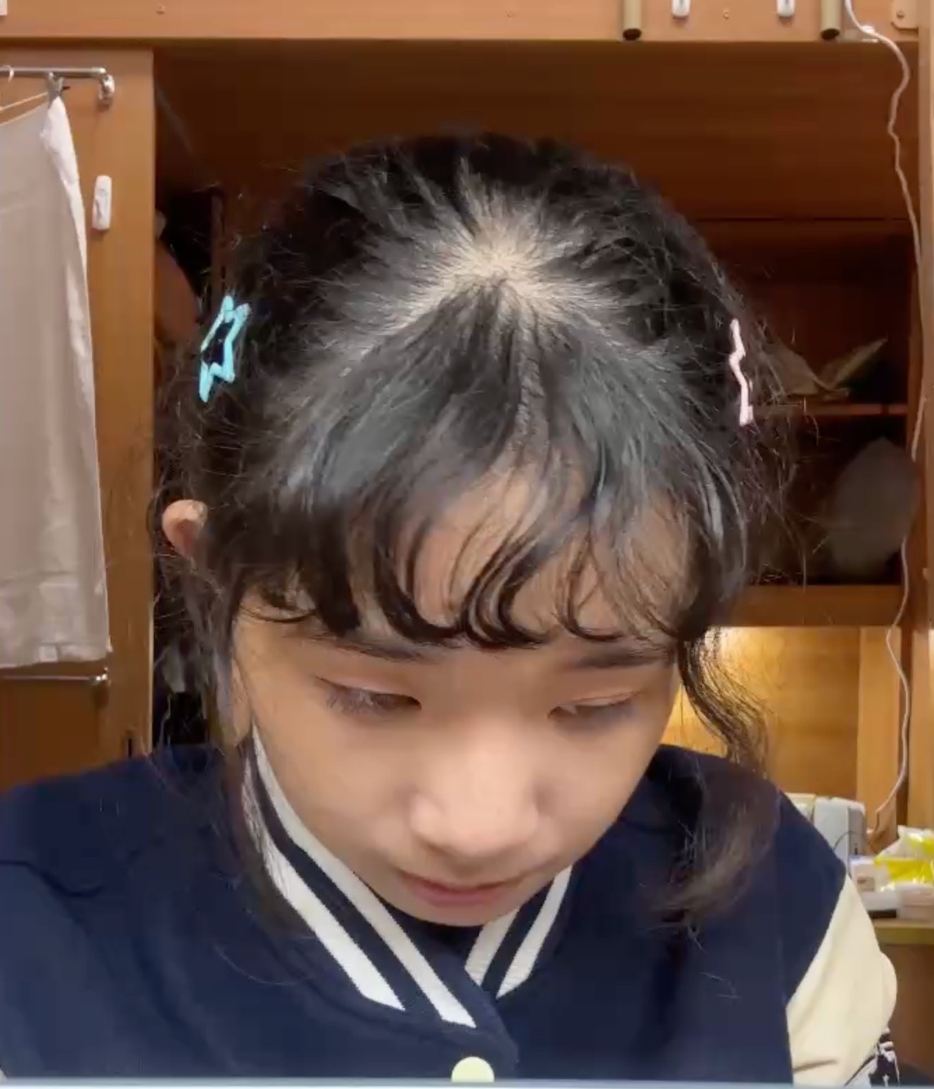 禹方 Before 照片